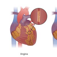 med_HeartOut med_HeartOut