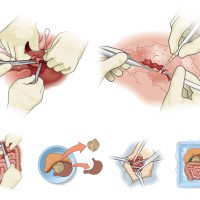 med_surgery med_surgery