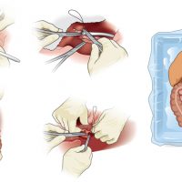med_surgeryGRP med_surgeryGRP